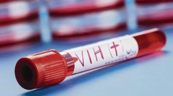 ¿Existe un vínculo entre las vacunas contra el coronavirus y el VIH?